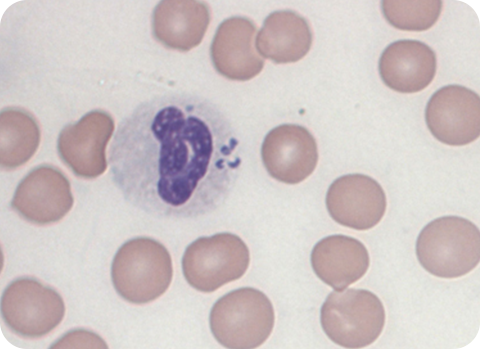 Anaplasmose wird durch die Zeckenart Gemeiner Holzbock übertragen und kann eine Störung der Blutgerinnung zur Folge haben.