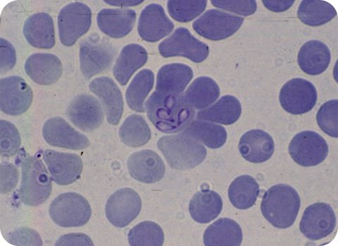 Babesiose wird auch Hundemalaria genannt und durch Babesien ausgelöst, die zum Tod der Tiere führen können.