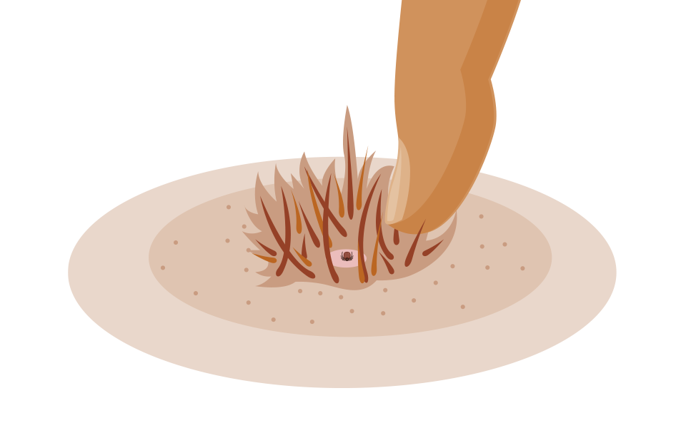 Um eine Zecke bei Hunden zu entfernen, sollte zunächst das Fell geteilt werden.