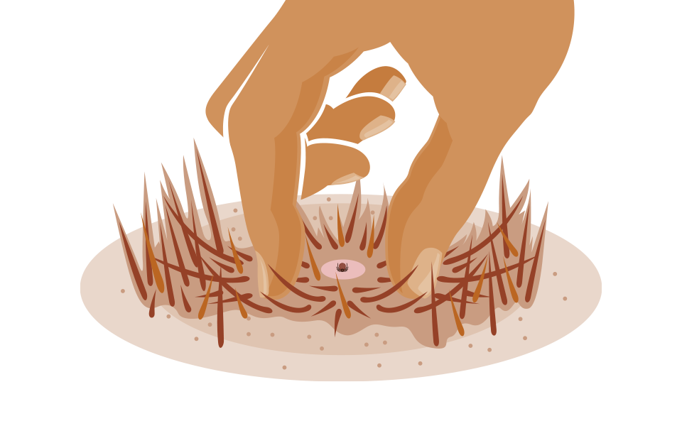 Zeckenhaken sind das ideale Werkzeug, um eine Zecke bei Hunden zu entfernen.