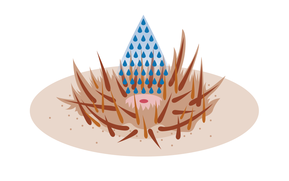 Nach der Entfernung einer Zecke sollte die Wunde im Hundefell mit einem Mittel behandelt werden.