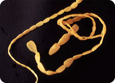 Die Glieder des Gurkenkernbandwurms geben der Bandwurmart ihren Namen und werden auch Proglottiden genannt.